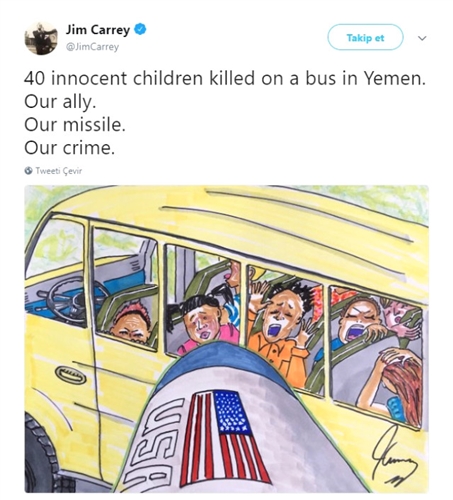 الممثل الأمريكي العالمي "جيم كاري".. صواريخنا تقتل أطفال اليمن