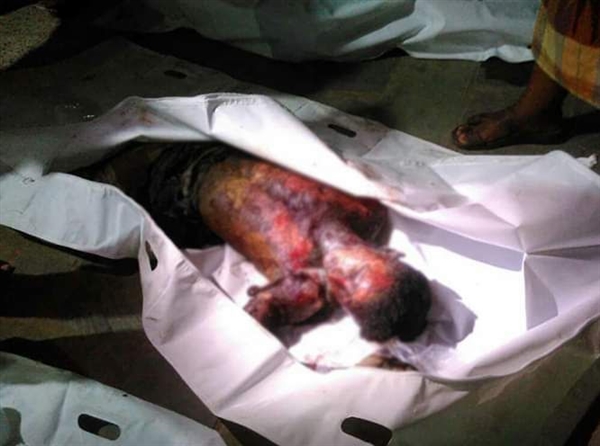 ارتفاع حصيلة قتلى قصف التحالف لعمال مصنع في الحديدة