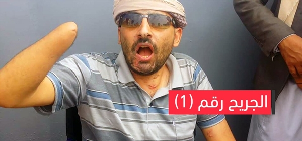 "سلطان الطلقي".. حكاية "موعد" مع عبوة ناسفة!!