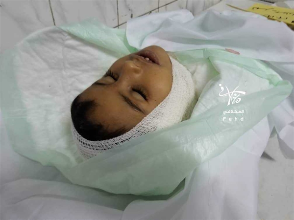 استشهاد طفل بقذيفة حوثية في تعز