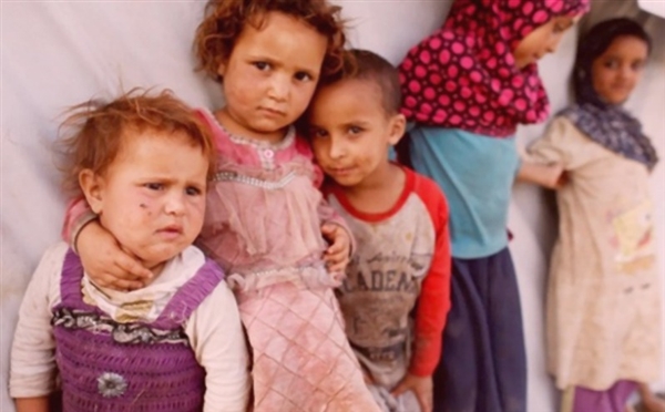 الأطفال اكبر ضحايا الحرب الأهلية في اليمن