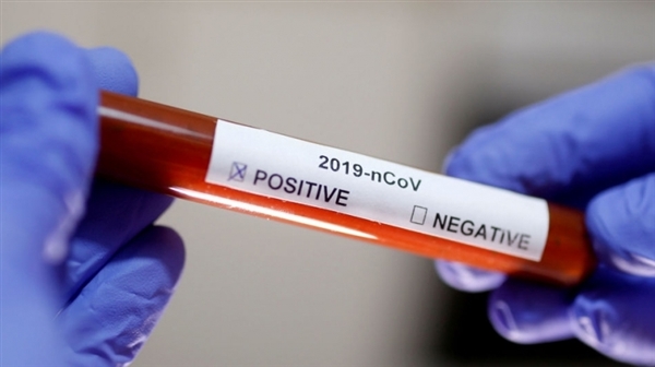 طرح أول تجربة لقاح ضد فيروس كورونا على البشر بأميركا