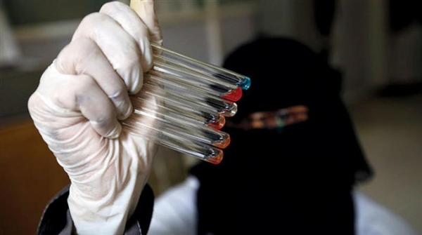 مليشيات الحوثي تحول «كوفيد ـ 19» إلى «جائحة منسية»... والموتى بالمئات