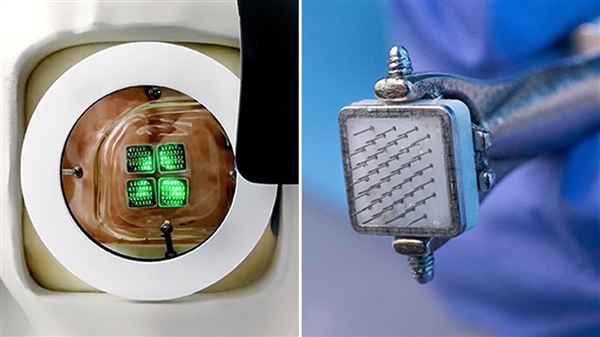 لعلاج العمى.. ابتكار عين اصطناعية يمكن ربطها بشريحة في الدماغ