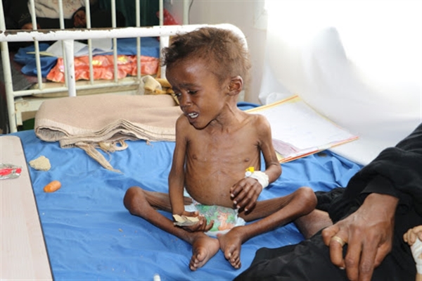 مليشيات الحوثي تواصل منع اللقاحات وسط تحذيرات من تفشي شلل الأطفال في صنعاء