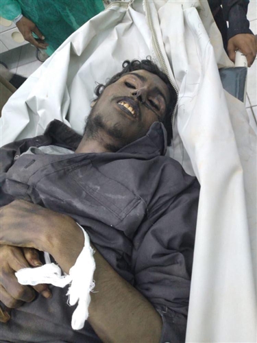 الشبكة اليمنية للحقوق تندد بجريمة تعذيب وإعدام محمد الصباري من قبل مليشيا الحوثي
