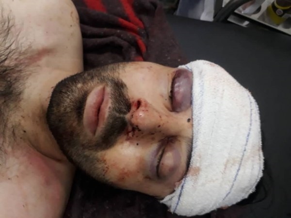 وزير الصحة التركي يوجه بنقل موظف الهلال الأحمر إلى تركيا