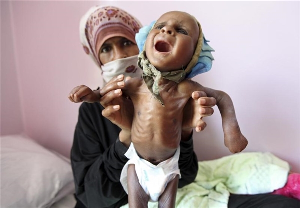 مزارعون في ايرلندا يجمعون أكثر من 100 ألف يورو لضحايا الحرب في اليمن