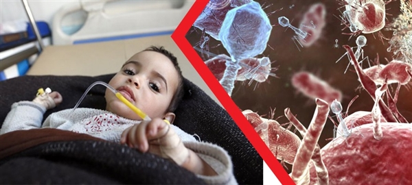 Yemen’de difteri salgını hızla yayılıyor