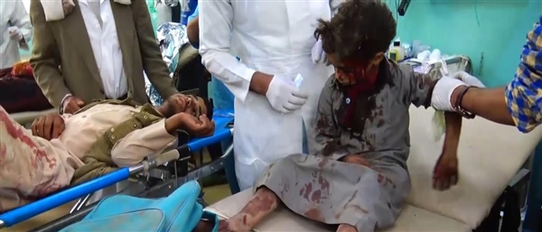 Koalisyon Yemen'de çocukların bombalanmasını "meşru eylem" olarak duyurdu