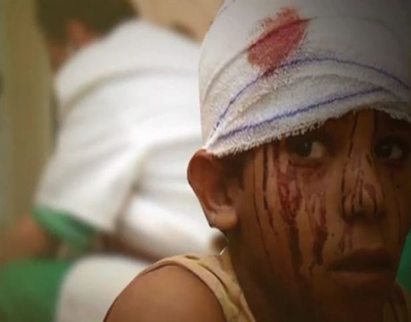 "Husiler 14 bin 220 Yemenliyi katletti"