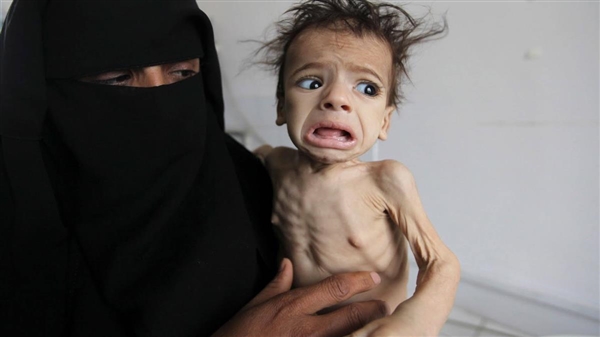 Yemen’de savaş en çok çocukları vurdu