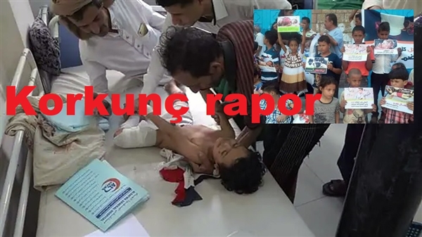 Husi keskin nişancılar Taiz’de 5 yılda 366 çocuğu vurdu