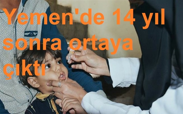 Yemen'de şimdi de çocuk felci salgını baş gösterdi