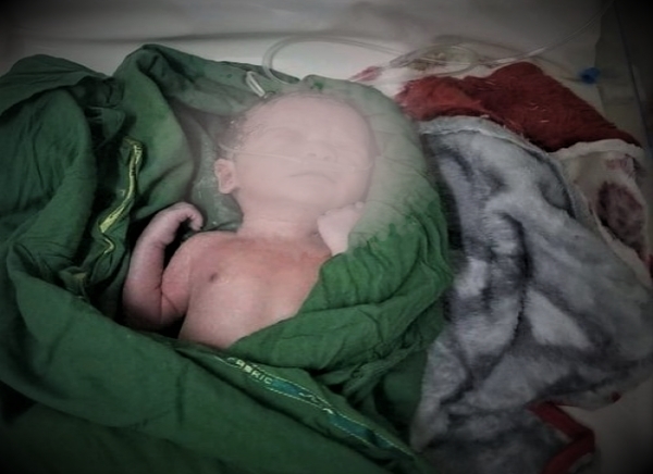Bombardımanda ölen hamile kadının bebeği  sağ olarak dünyaya geldi
