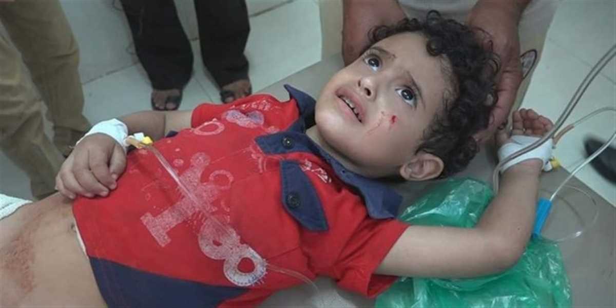 إصابة ثلاثة أطفال جراء سقوط قذيفة حوثية على حي سكني في تعز