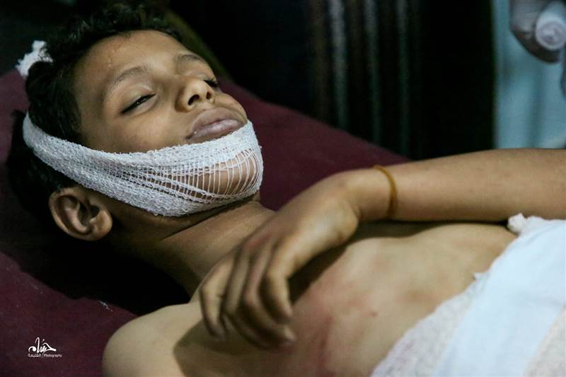 سلطات تعز: المجتمع الدولي والأمم المتحدة شركاء الحوثي في قتل اليمنيين