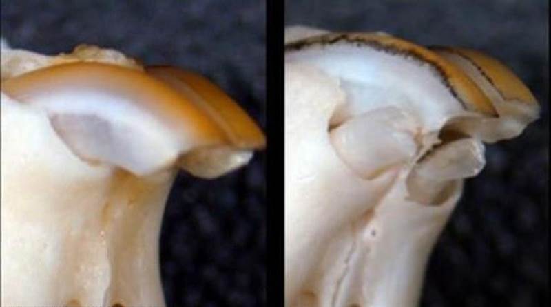 علماء يطورون علاجاً جديداً يوفر سيوفر "الأمل" لملايين الأشخاص