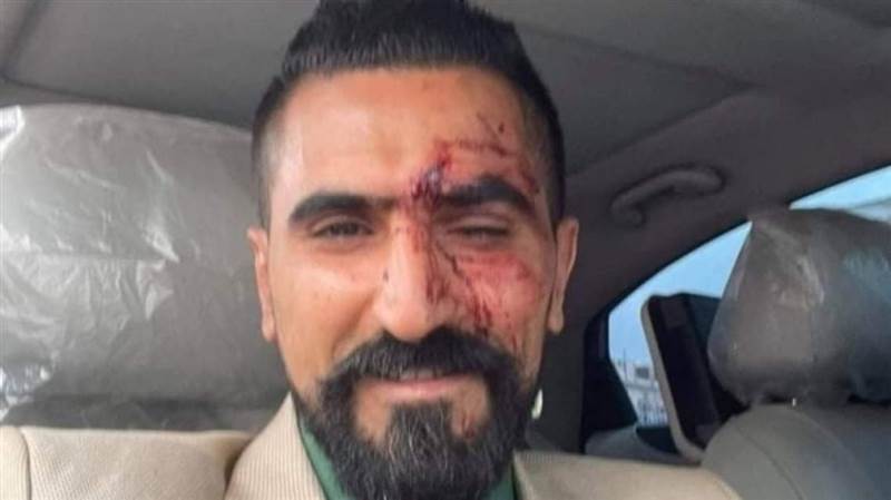صنعاء: 11 مسلحاً يهاجمون محامي الأغبري بعد حكم بإعدام القتلة