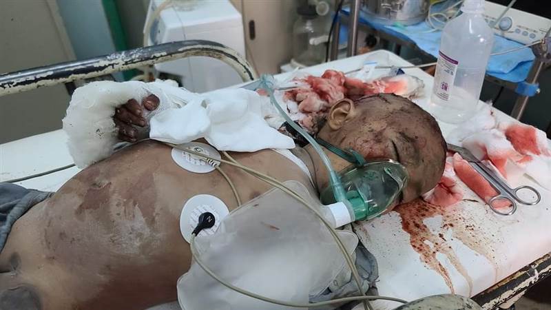 البرلمان يدين مجزرة مأرب ويحمل المجتمع الدولي المسؤولية ويدعو لتصنيف الحوثي "إرهابية"