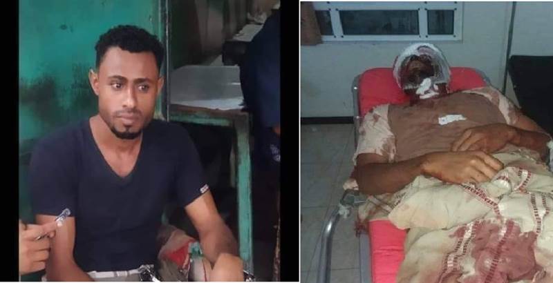 في جريمة بشعة يندى لها الجبين بتعز.. طالب المشرف بدفع "قيمة السمك" فأعدمه على الملأ