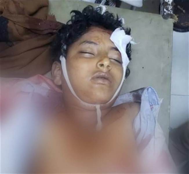 استشهاد طفل برصاص قناص المليشيات في تعز