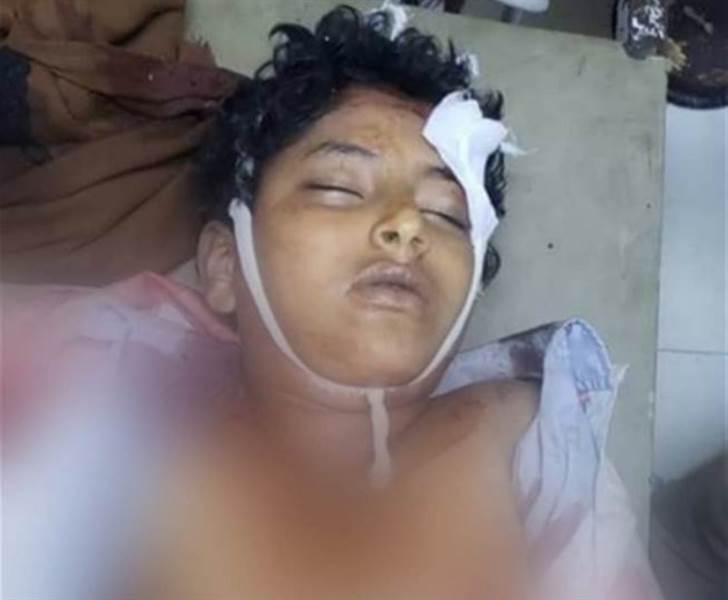 Taiz'de Husi kesin nişancı, okuldan dönen çocuğu katletti