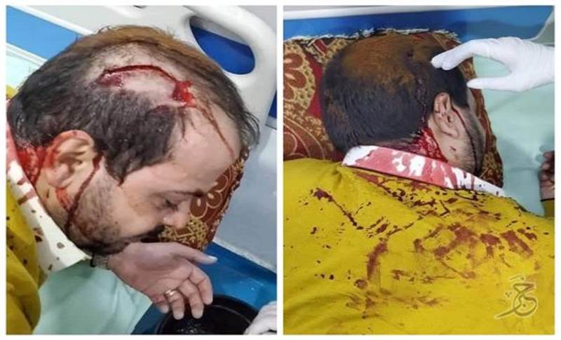 مليشيات الحوثي تعتدي على رجل الأعمال أحمد الكبوس بعد رفضه دفع اتاوات