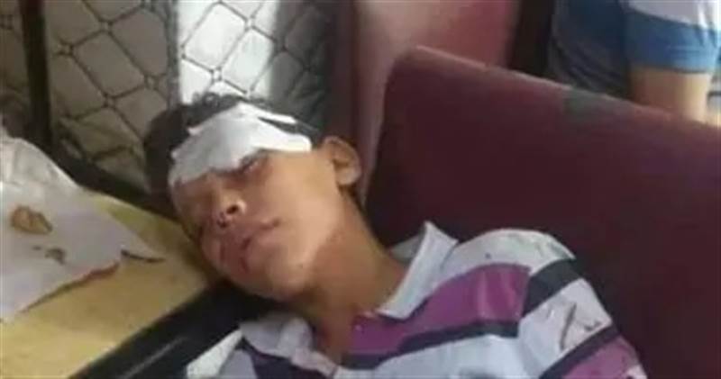 أرقام صادمة وحالات وفاة تتزايد ..داء خطير ينتشر في اليمن وسط تحذيرات طبية