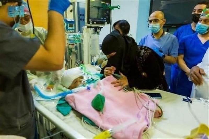 بعد أنباء عن نجاح فصلهما.. وفاة التوأم السيامي "ياسين" بعد ساعات من فصله عن أخيه يوسف