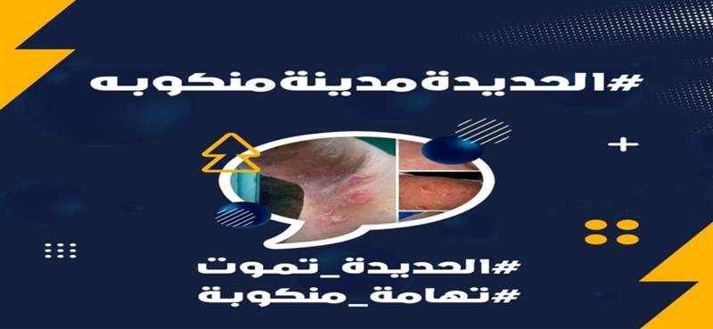 #الحديدة_مدينه_منكوبه .. حملة إلكترونية تسلط الضوء على معاناة السكان جراء حر الصيف وانقطاع الكهرباء