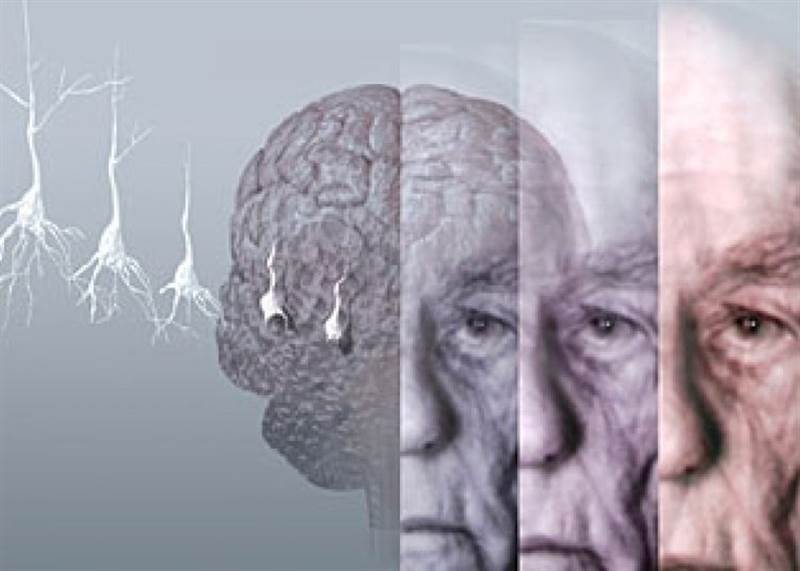 دراسة أسترالية حديثة: نقص هذا الفيتامين "المهم جدا" يؤدي إلى تدهور الدماغ