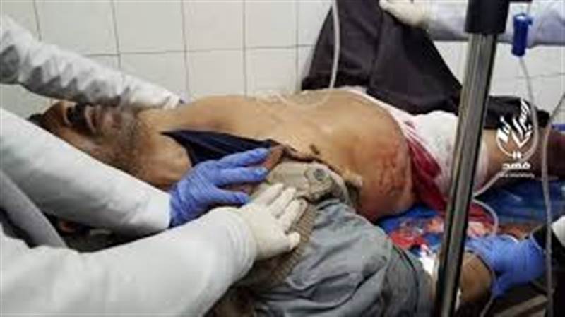 إصابة مواطن برصاص قناص حوثي في تعز