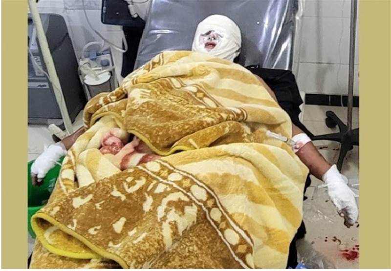 Yemen’in İbb kentinde iş bulamayan ve bunalıma giren bir kişi kendini yaktı