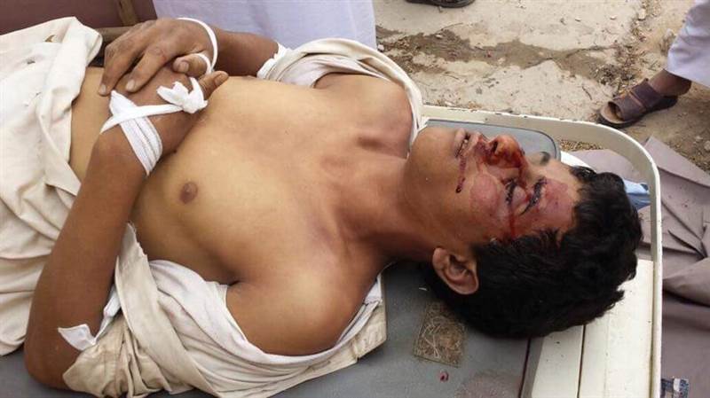 في جريمة بشعة بصعدة.. قيادي حوثي يضرب شاباً حتى الموت أمام أهله