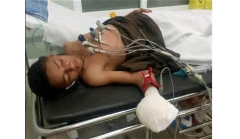 جريمة بشعة ببصمات حوثية.. مسلح مجهول يسلم طفل قنبلة "هدية" لتنفجر به بمحافظة إب