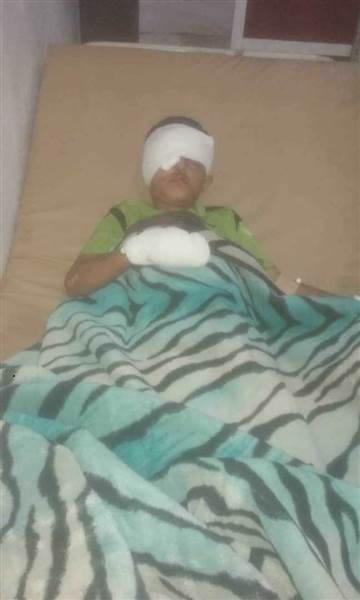 El Beyda kentinde Husilerin geride bıraktığı patlayıcının infilak etmesi sonucu 5 çocuk yaralandı