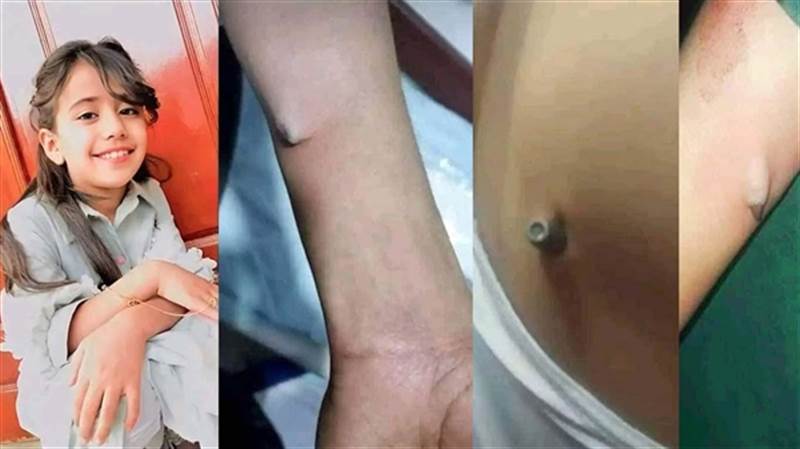 Yemen’de milli takımın galibiyet kutlamalarında maganda kurşunundan 33 kişi öldü ve yaralandı