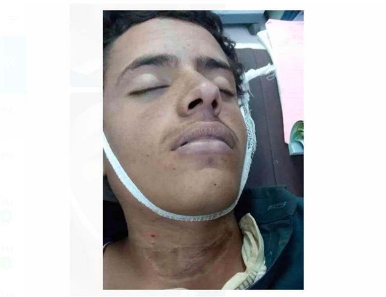 بعد رجوعه من دورة طائفية.. مجند حوثي يشنق نفسه بمحافظة عمران