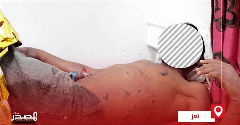 Taiz'de kaçırılan bir kişi Husi milis hapishanelerinde gördüğü işkence sonucu hayatını kaybetti