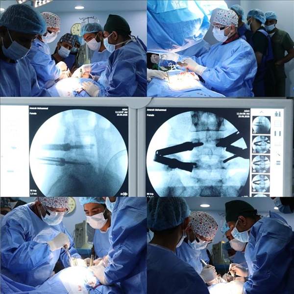 Aden’de Tıbbi Bir Devrim: Yemen’de İlk Kez Geleneksel Kesme Olmadan Omurga Ameliyatı Yapıldı