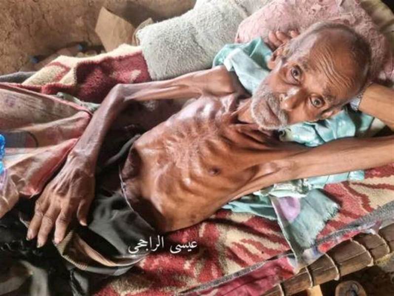 بعد رصد حالة وفاة.. الجوع يضرب مخيمات النازحين في محافظة حجة وينذر بكارثة وشيكة