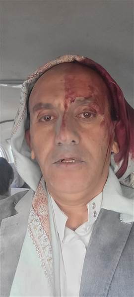 نجا بأعجوبة كما قال ..صحفي حوثي يفر من موت محقق بعد قصف إسرائيلي استهدف صحيفة "26 سبتمبر" بصنعاء مساء اليوم
