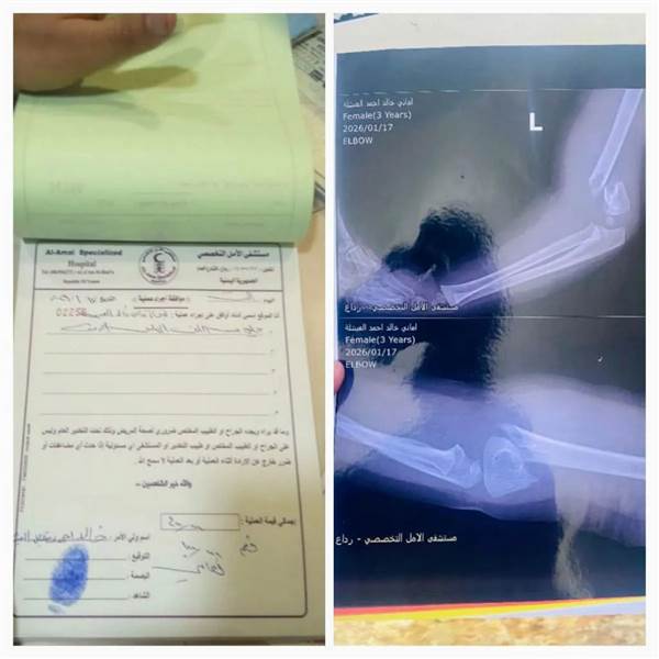 وفاة غامضة لفتاة في رداع بعد عملية “بسيطة”.. أسرة تتهم مستشفى خاص بالإهمال وتطالب بالتحقيق