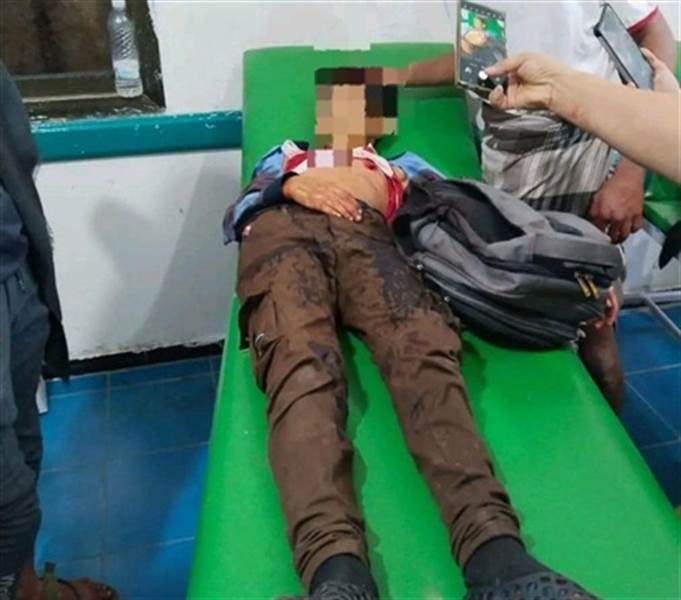 في جريمة جديدة..رصاصة حوثية تغتال طفولة في تعز.. قنّاص يستهدف تلميذاً عائداً من المدرسة